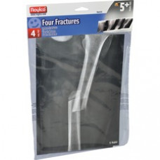 Roylco Four Fractures X-ray Sheets - Theme/Subject: Radiology - Skill Learning: Radiography - 4 Pieces - 5+ - 4 / Pack